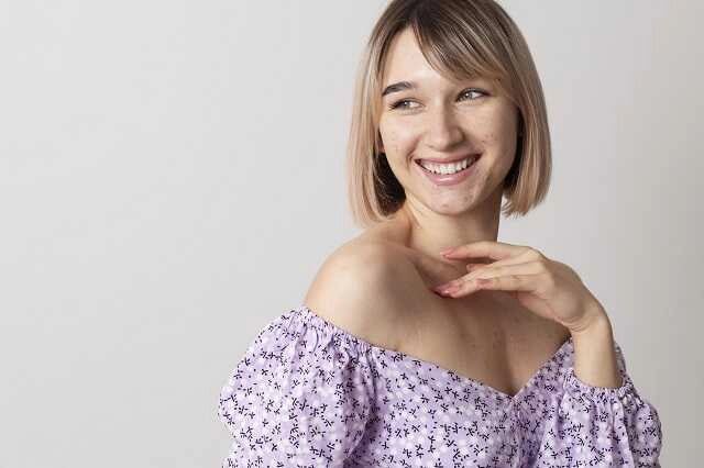 Kobieta z bliznami po trądziku