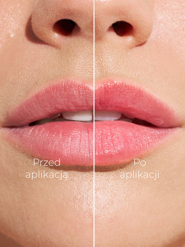 CHAMELEON - BALSAM DO UST REAGUJĄCY Z PH