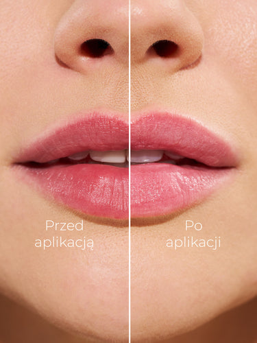 CHAMELEON ROSA - BALSAM DO UST