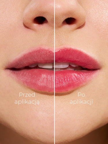 CHAMELEON RICH B*TCH - BALSAM DO UST