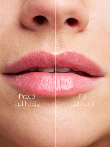 WATERMELON LIP BALM - ARBUZOWY BALSAM DO UST