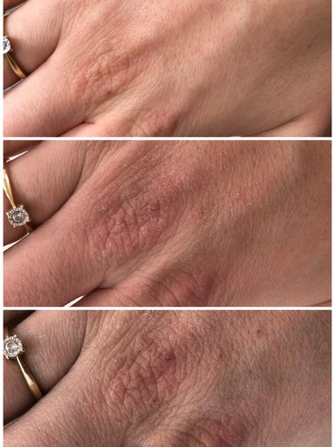 HUDSALVA VIT. E - MAŚĆ DO SKÓRY SUCHEJ