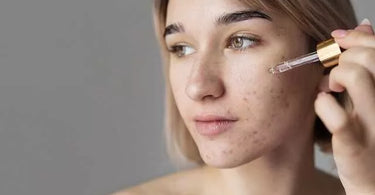 Sebum – jak radzić sobie z jego nadmiarem? Częsty problem skóry tłustej i mieszanej