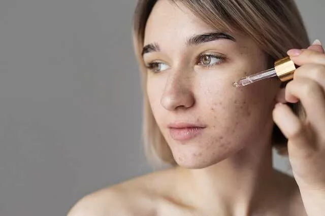 Sebum – jak radzić sobie z jego nadmiarem? Częsty problem skóry tłustej i mieszanej