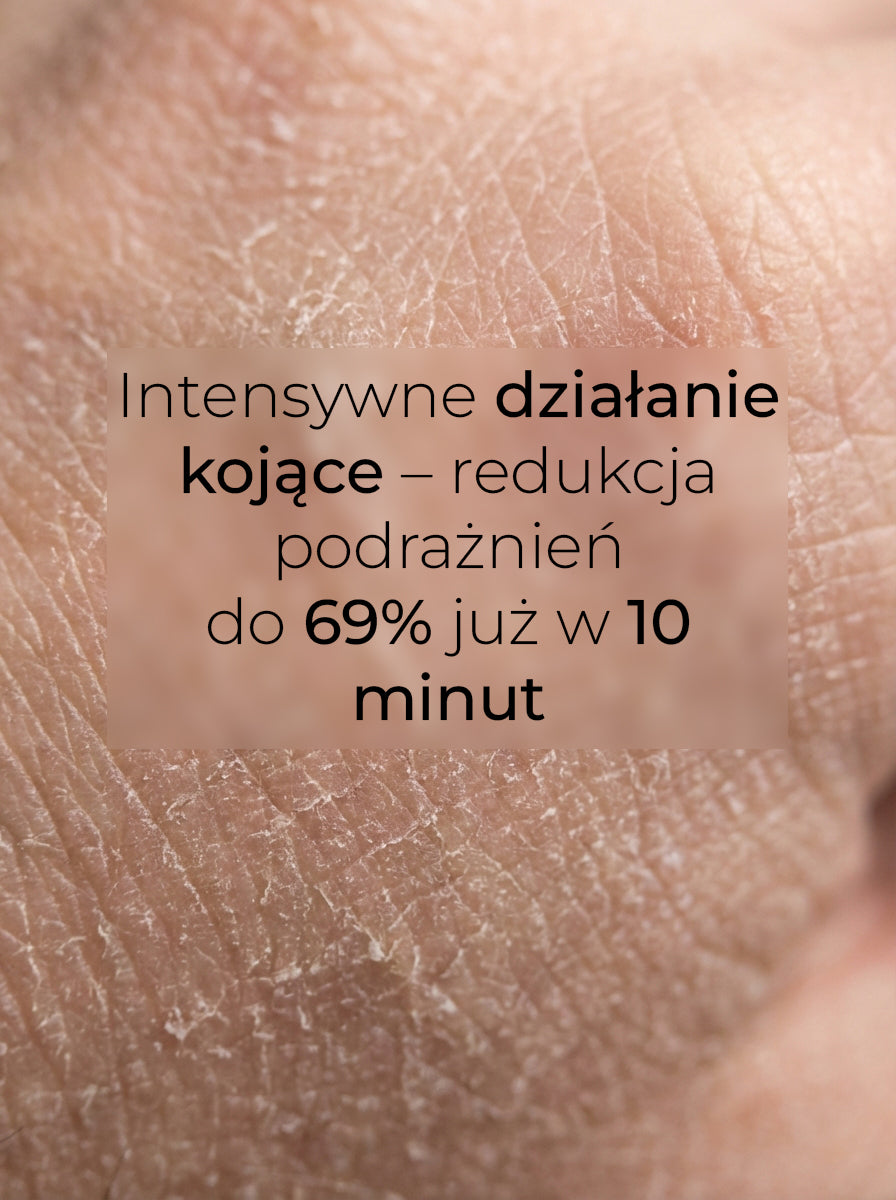 Hudsalva vit. E 100 ml — Ukojenie dla skóry reaktywnej, wrażliwej, a nawet naczynkowej