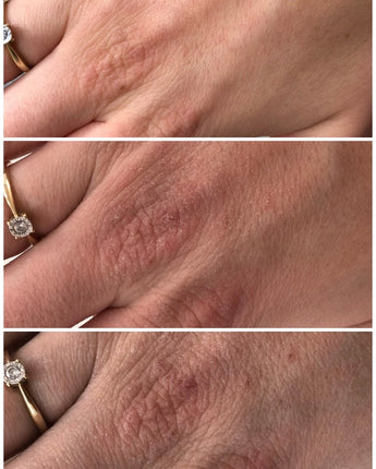 HUDSALVA VIT. E 50 ML - MAŚĆ DO SKÓRY SUCHEJ